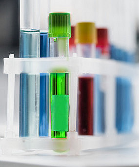 Photo: A row of test tubes. The focus is on a test tube containing green liquid.